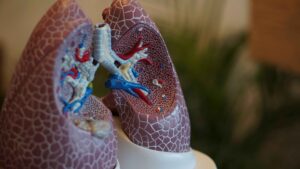 Lung Cancer Treatment Options: A Comprehensive Guide to Alternative and Integrative Therapies