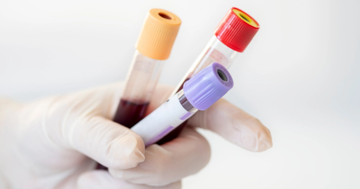 blood draw